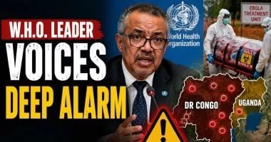 الصحة العالمية تصدر إرشادات جديدة لعلاج الإيبولا وماربورج