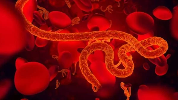 الوقاية من إيبولا: 6 إجراءات فعالة لحماية نفسك