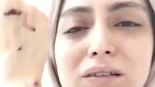 اعتداء على طبيبة أسنان في شبرا الخيمة