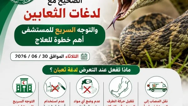 التعامل الصحيح مع لدغات الثعابين في الشرقية
