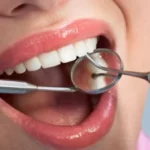 علاقة نزيف اللثة بمشكلات الكلى