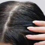 أسباب ظهور الشعر الأبيض مبكرًا وكيفية التعامل معه