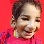 رحلة أنس مع مرض نادر: من الصدمة إلى تقبل الذات