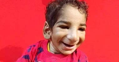 رحلة أنس مع مرض نادر: من الصدمة إلى تقبل الذات