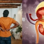علامات تحذيرية تكشف حصوات الكلى وألم الظهر