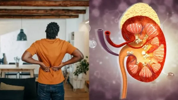 علامات تحذيرية تكشف حصوات الكلى وألم الظهر