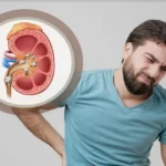 علامات تدل على الإصابة بحصوات الكلى