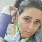 نورهان تعلن إصابتها وتضع يدها في الجبس