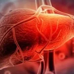 أطباء يحذرون: تنظيف الكبد ليست وصفات سحرية