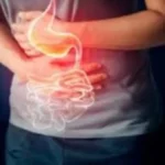 فوائد الخيار لعلاج حرقة المعدة