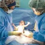 جهود وزارة الصحة للحد من الولادة القيصرية غير المبررة