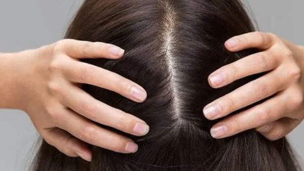 ماسك طبيعي لمعالجة تقصف الشعر في الصيف