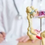 آلية جديدة تفسر عودة سرطان القولون بعد العلاج