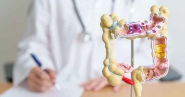 آلية جديدة تفسر عودة سرطان القولون بعد العلاج
