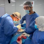 967 عملية جراحية في الشرقية للقضاء على قوائم الانتظار