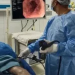 أحدث منظار في حميات الزقازيق لتشخيص الأورام