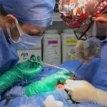نجاح جراحة معقدة لرضيع بمستشفى القنايات في الشرقية